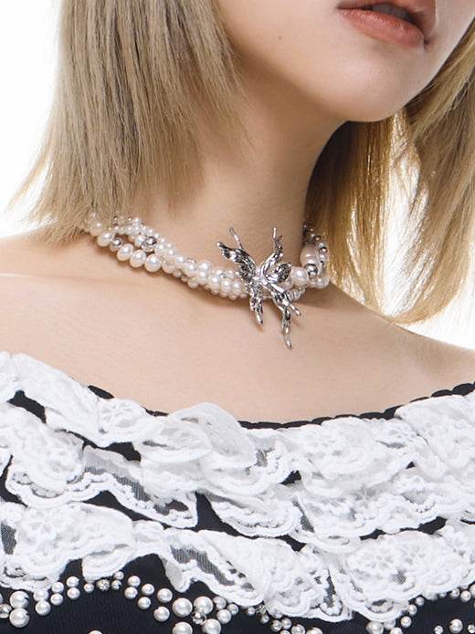 Butterfly clavicle - MOWTE