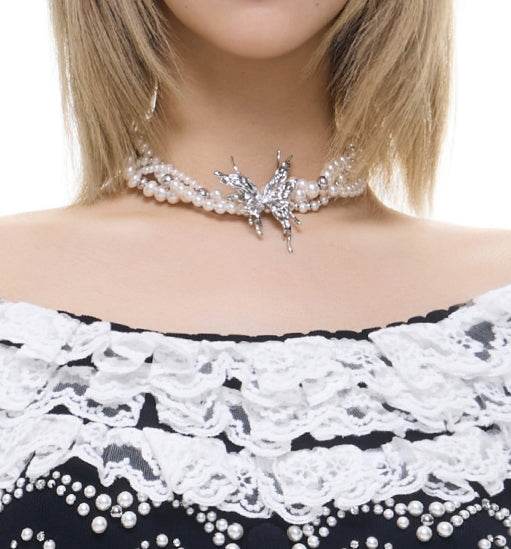 Butterfly clavicle - MOWTE